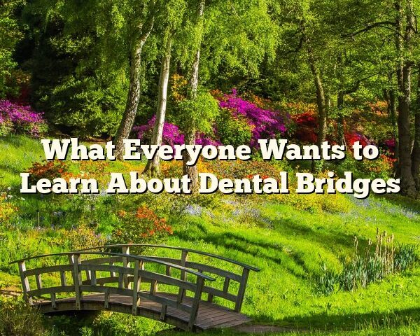 What Everyone Wants to Learn About Dental Bridges